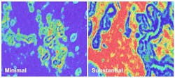 Slides showing minimal disruption (left) and substantial disruption (right) in breast stromal tissue. Courtesy of NIH/NCI. Slides showing minimal disruption (left) and substantial disruption (right) in breast stromal tissue. Courtesy of NIH/NCI.