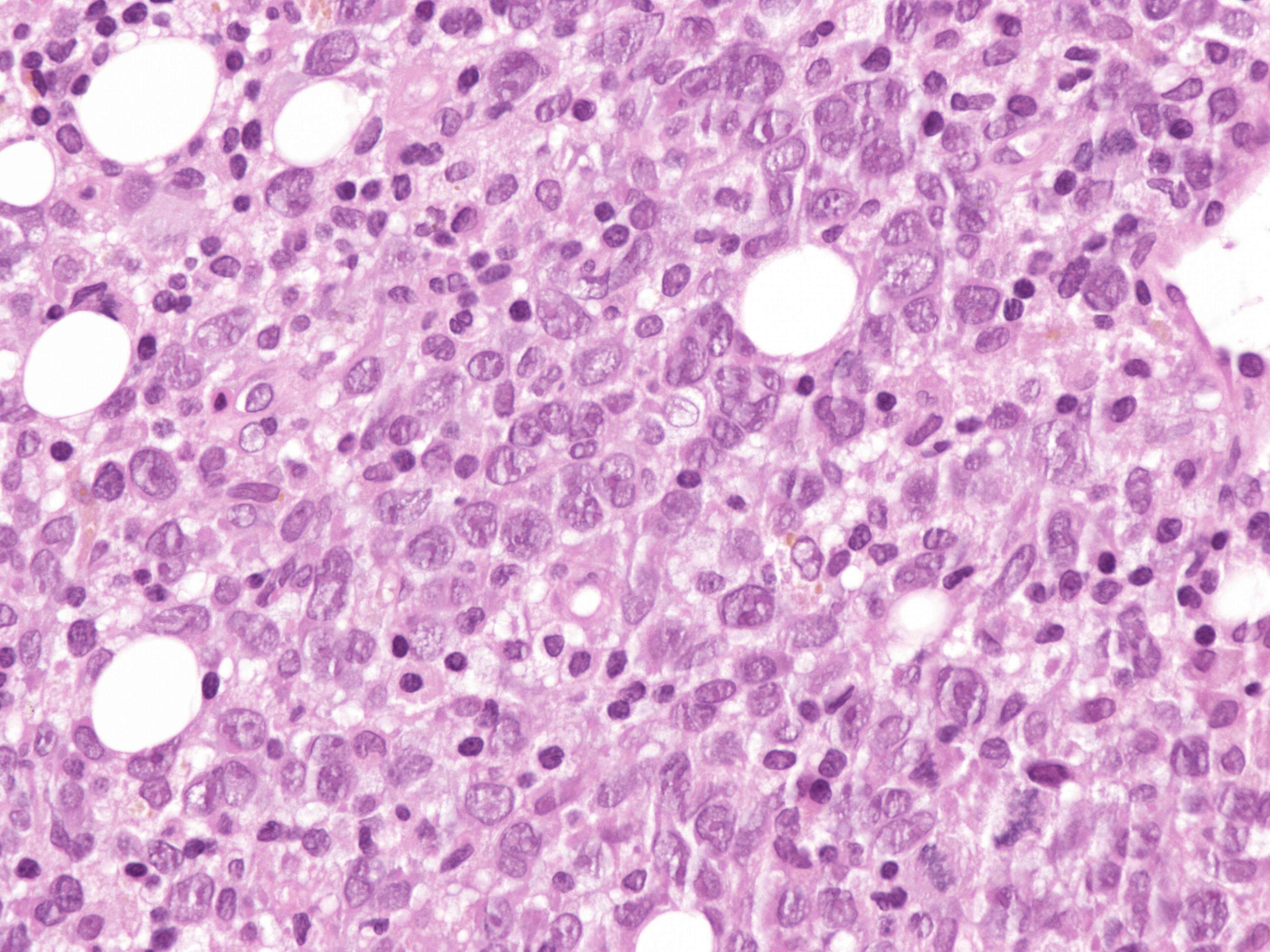 dreamstime_xxl_342822543_1