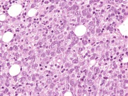 6835c373e35f0b1a53f27731 Dreamstime Xxl 342822543 1 6835c373e35f0b1a53f27731 Dreamstime Xxl 342822543 1