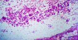 683dd2c2f7a019dc5efbc914 Dreamstime Xxl 181938771 683dd2c2f7a019dc5efbc914 Dreamstime Xxl 181938771