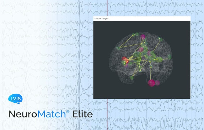 Visual showing NeuroMatch Elite interface by LVIS, featuring a 3D brain model with colored nodes and connecting lines representing brain activity, overlaid on an EEG background. Image courtesy of LVIS Corporation.