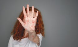 68517bcf61d46516480a9250 Dreamstime Xxl 147313905 68517bcf61d46516480a9250 Dreamstime Xxl 147313905