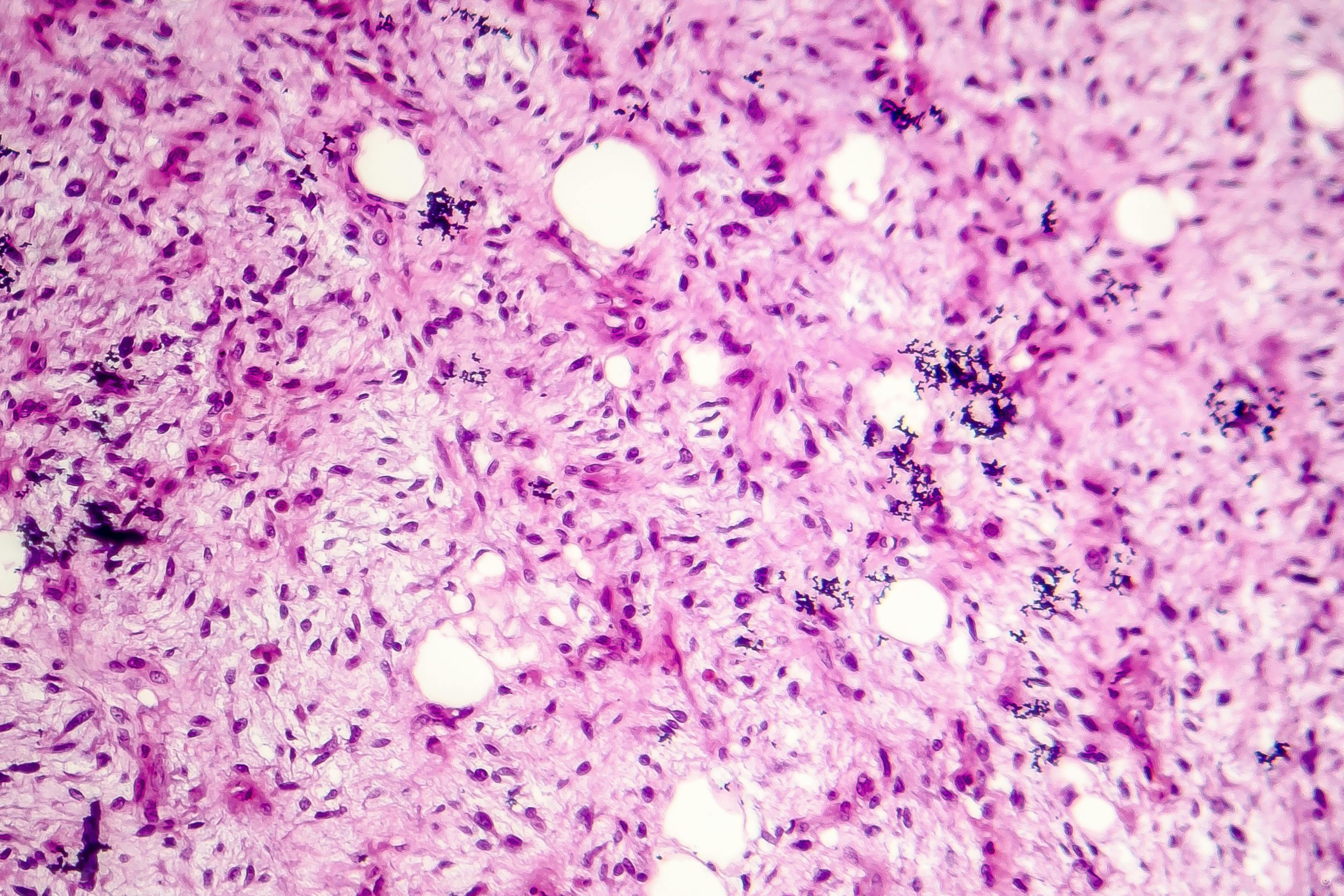 685ea9dc66e7a1c5e51d258f Dreamstime Xxl 123911421