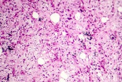 685ea9dc66e7a1c5e51d258f Dreamstime Xxl 123911421 685ea9dc66e7a1c5e51d258f Dreamstime Xxl 123911421