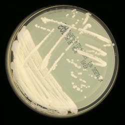 Candidozyma auris on standard Sabauraud dextrose agar. Candidozyma auris on standard Sabauraud dextrose agar.