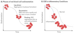 Figure 1. A) Three phases of red blood cell sedimentation. B) Shift in sigmoid ESR curve to the left in the presence of inflammatory proteins, increasing the rate of sedimentation. Figure 1. A) Three phases of red blood cell sedimentation. B) Shift in sigmoid ESR curve to the left in the presence of inflammatory proteins, increasing the rate of sedimentation.