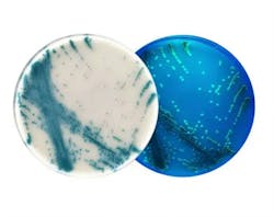 Candidozyma auris on chromogenic media. Candidozyma auris on chromogenic media.