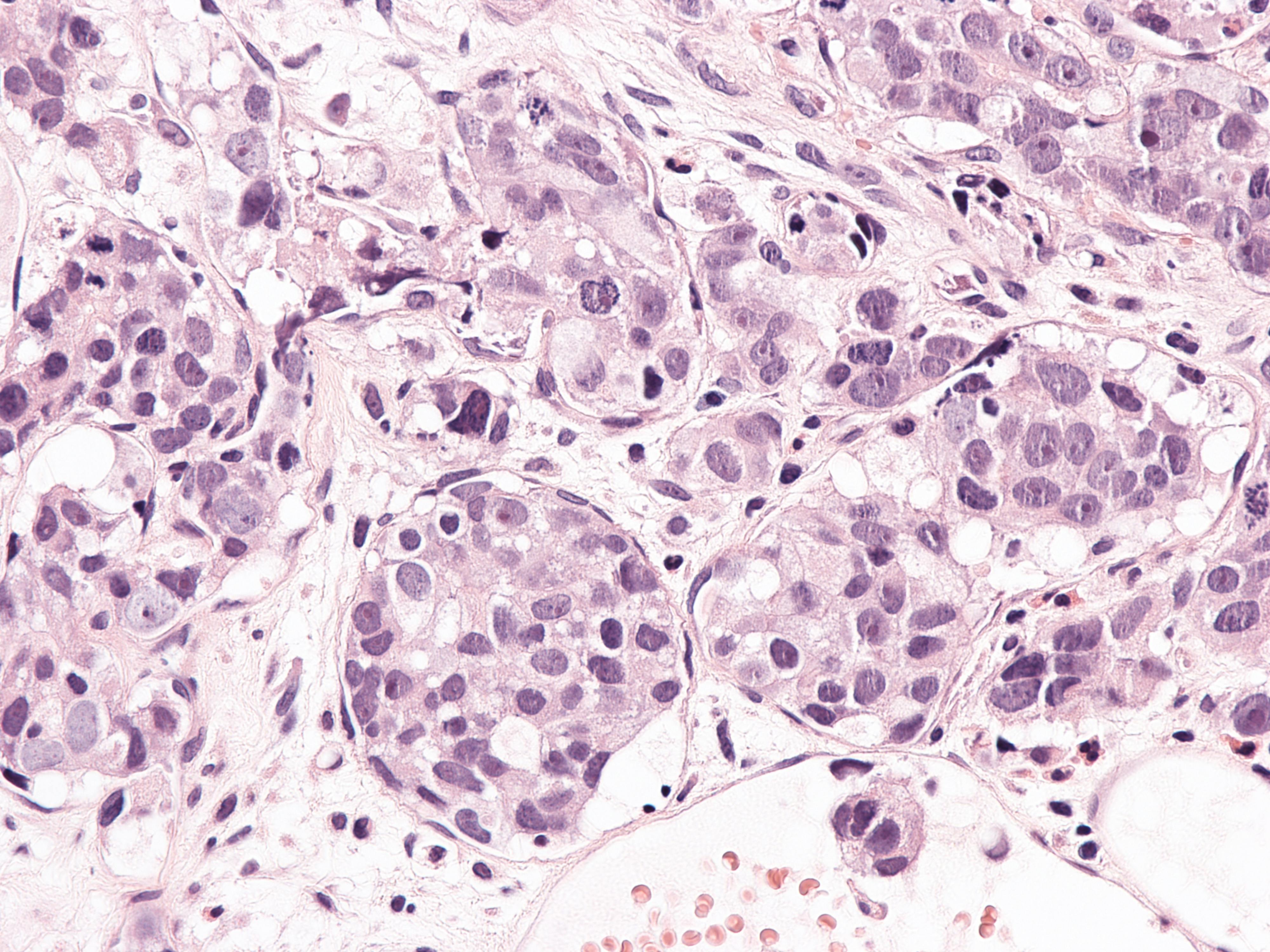 68baf29166f845456ec437d7 Dreamstime Xxl 335074638