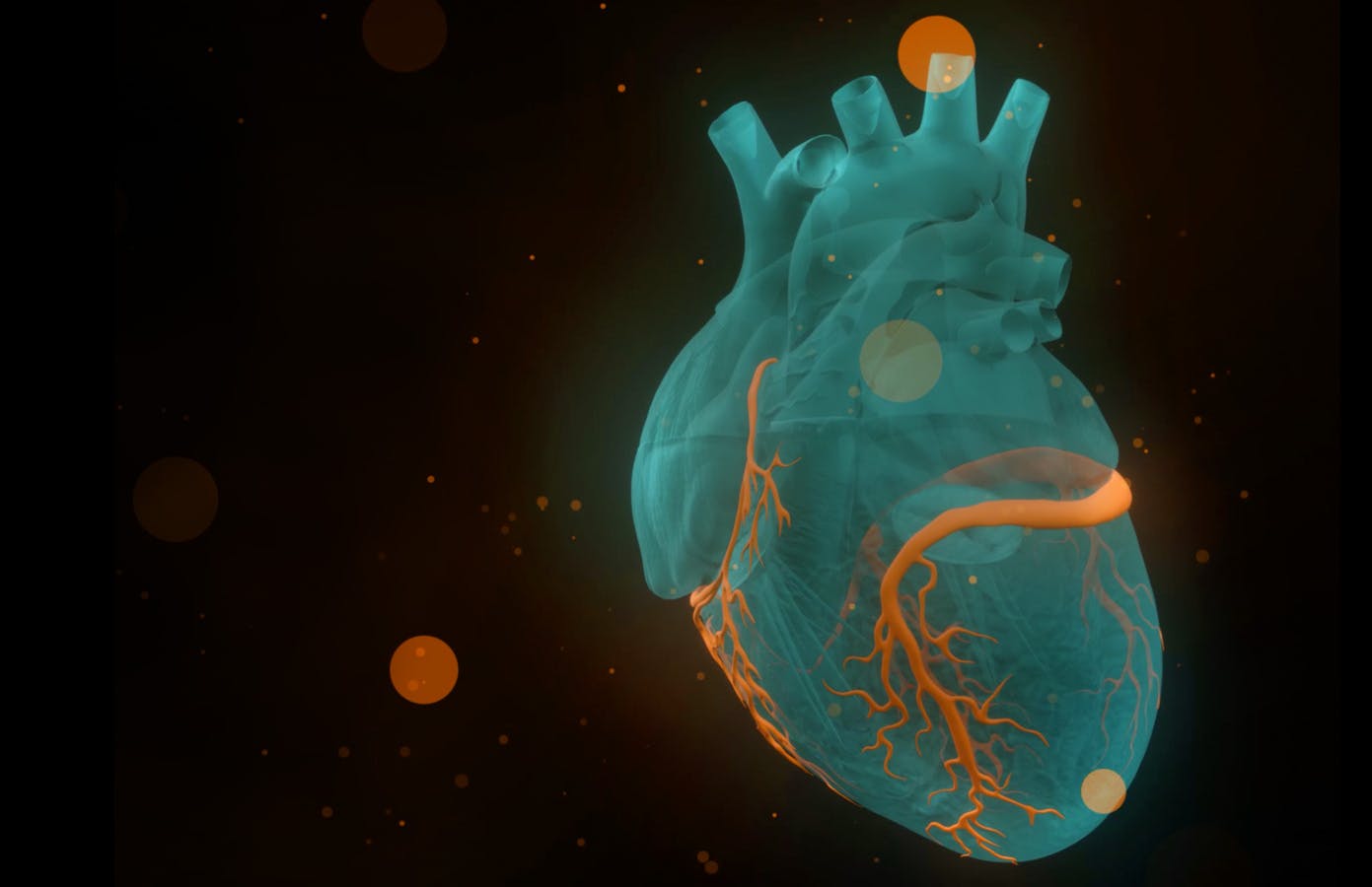 cls4282_cardiac_mlo_ask_the_expert_graphic_2