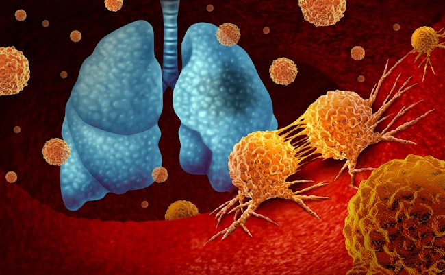 68e91460ed0a570940107545 Dreamstime Xxl 332622718