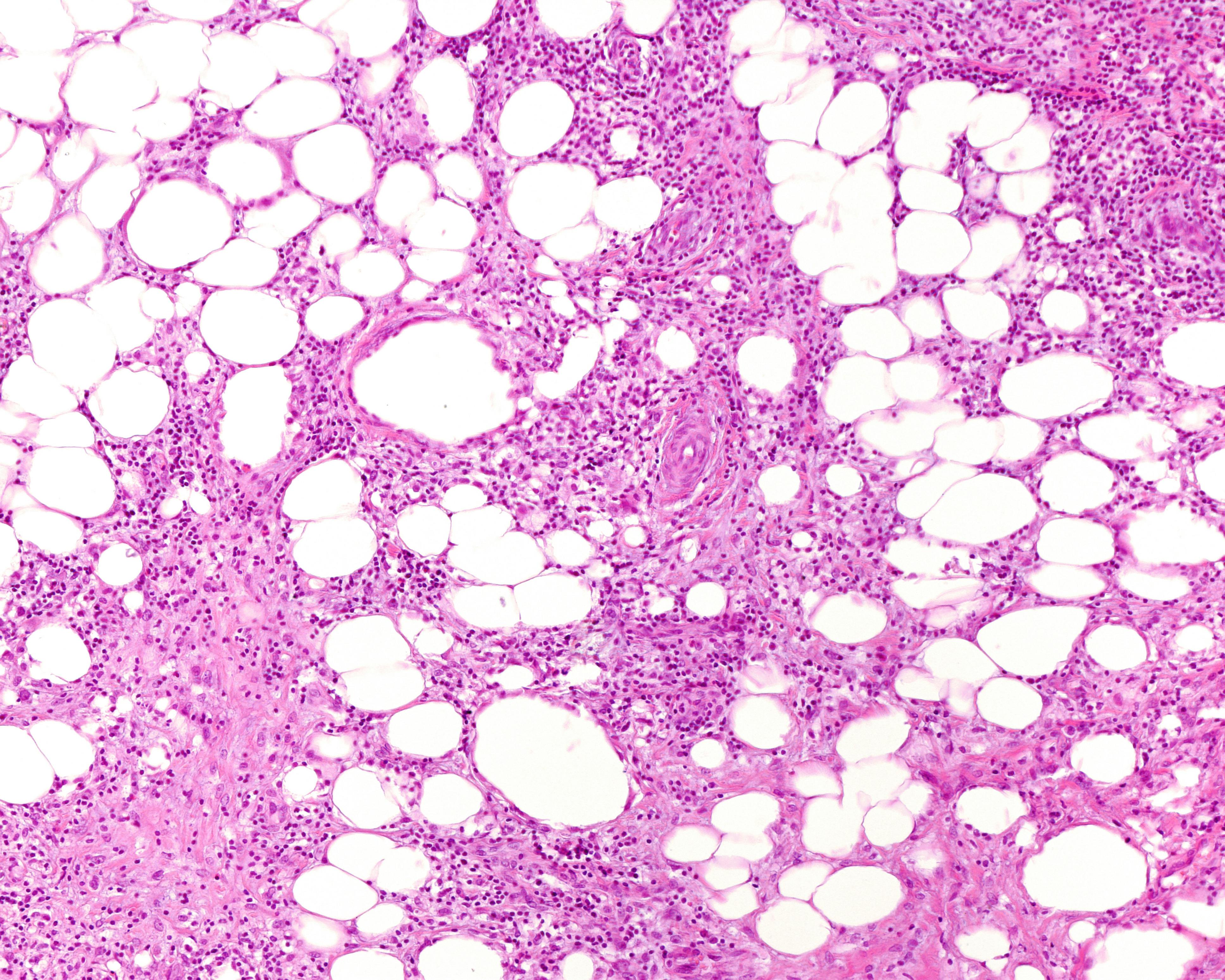 68ed0b9bbd0f01185b392460 Dreamstime Xxl 281280335