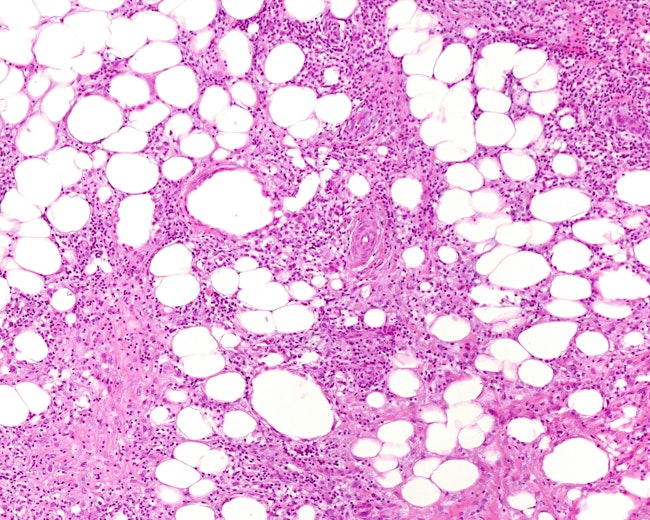 68ed0b9bbd0f01185b392460 Dreamstime Xxl 281280335