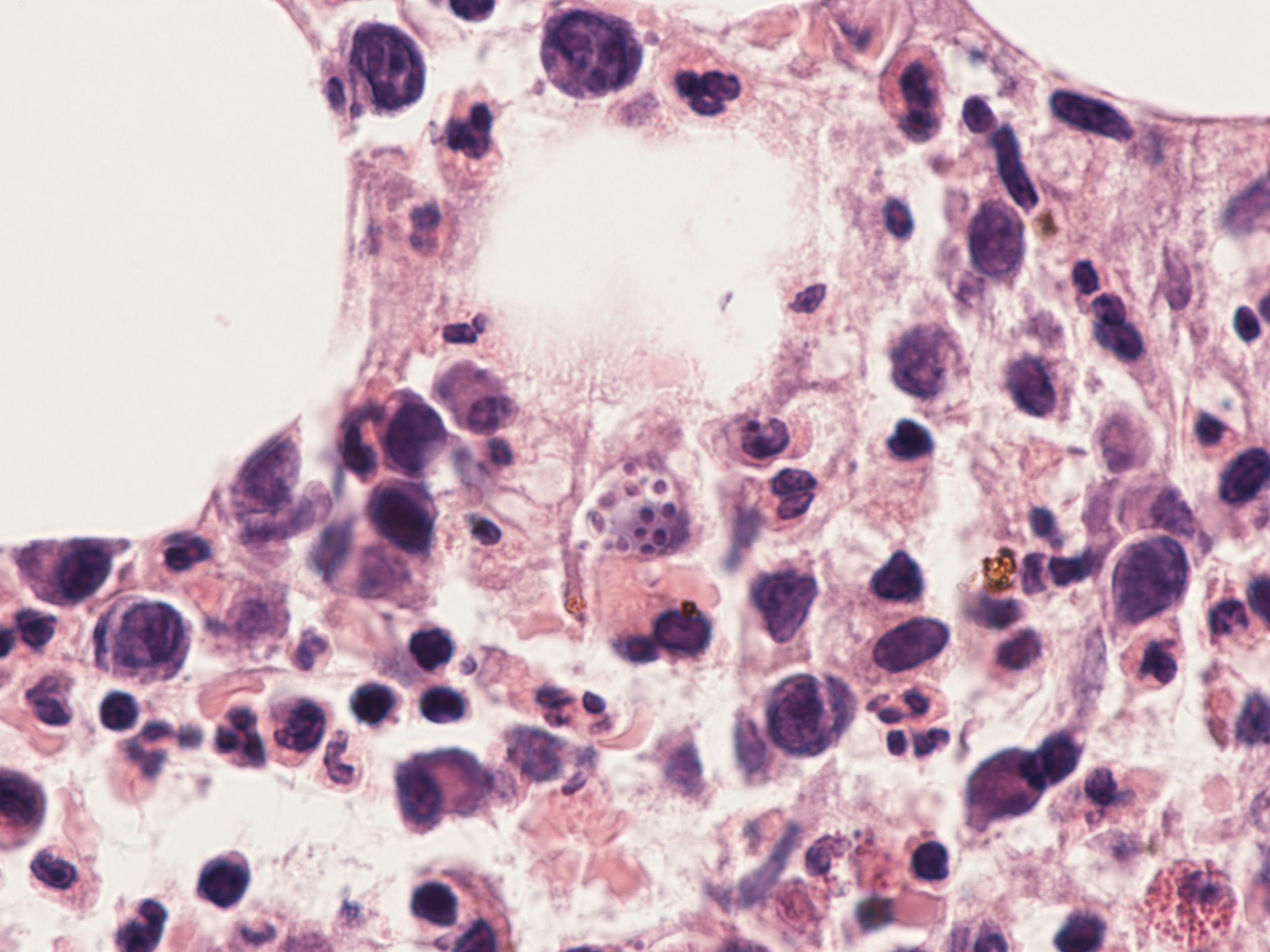 69174635fe90a3cd76a1eba8 Dreamstime Xxl 417226589