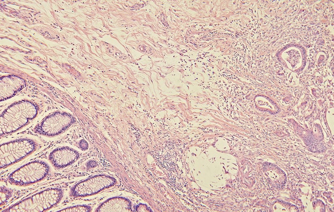 69174aa15f4427b2fac222dc Dreamstime Xxl 4972793