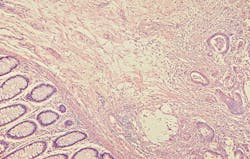 69174aa15f4427b2fac222dc Dreamstime Xxl 4972793 69174aa15f4427b2fac222dc Dreamstime Xxl 4972793