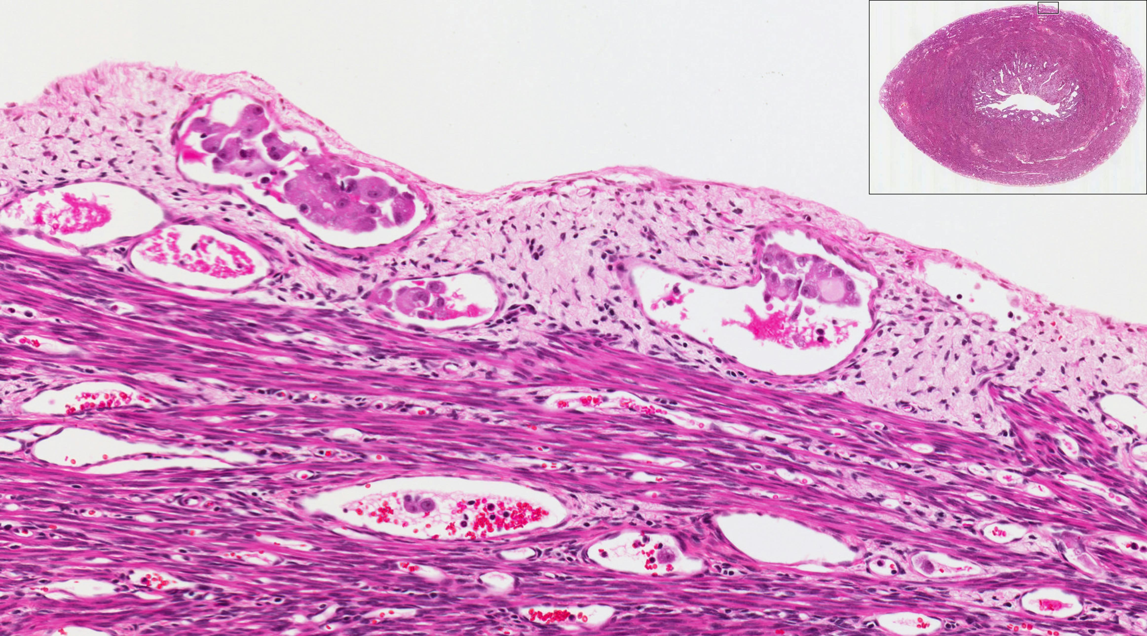 691c8f699ecbdf64f32257de Dreamstime Xxl 18889635