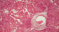 dreamstime_xxl_137226375 dreamstime_xxl_137226375