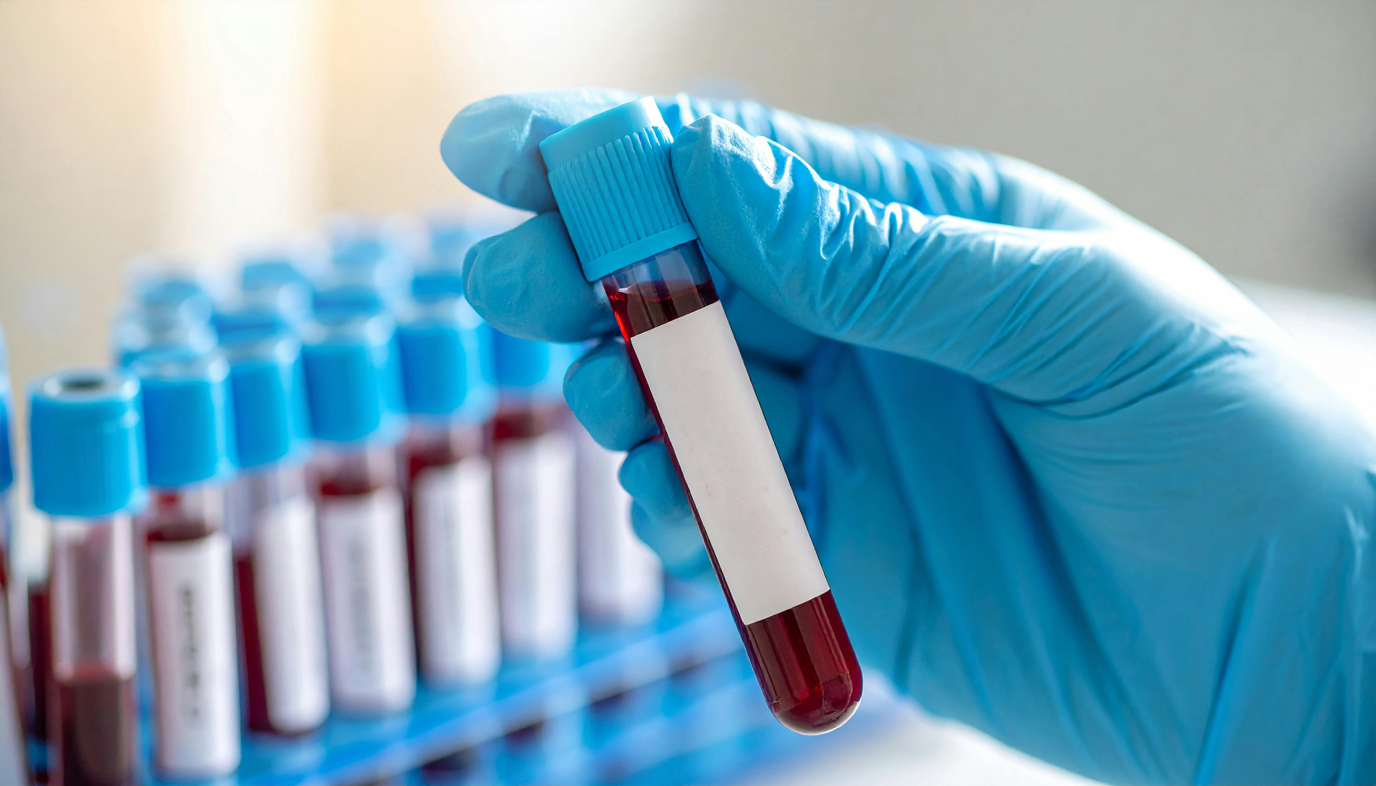 692722e924f622527d9ebfd3 Adobestock 1532806315