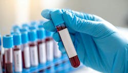 692722e924f622527d9ebfd3 Adobestock 1532806315 692722e924f622527d9ebfd3 Adobestock 1532806315