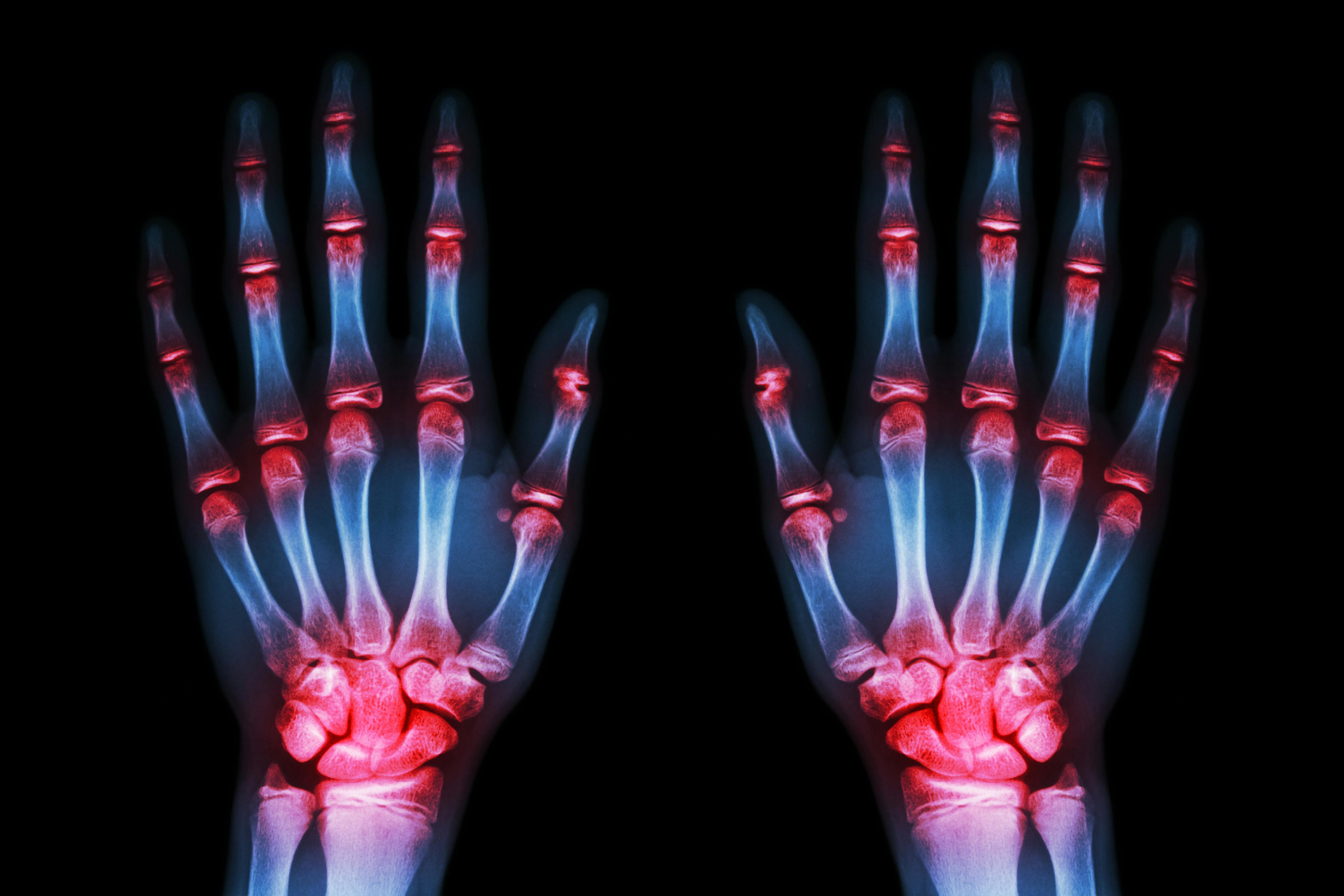 dreamstime_xxl_48512554