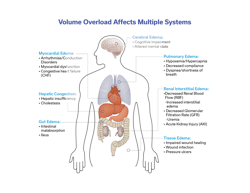 Figure 1. Effect of volume overload on multiple systems. Figure 1. Effect of volume overload on multiple systems.