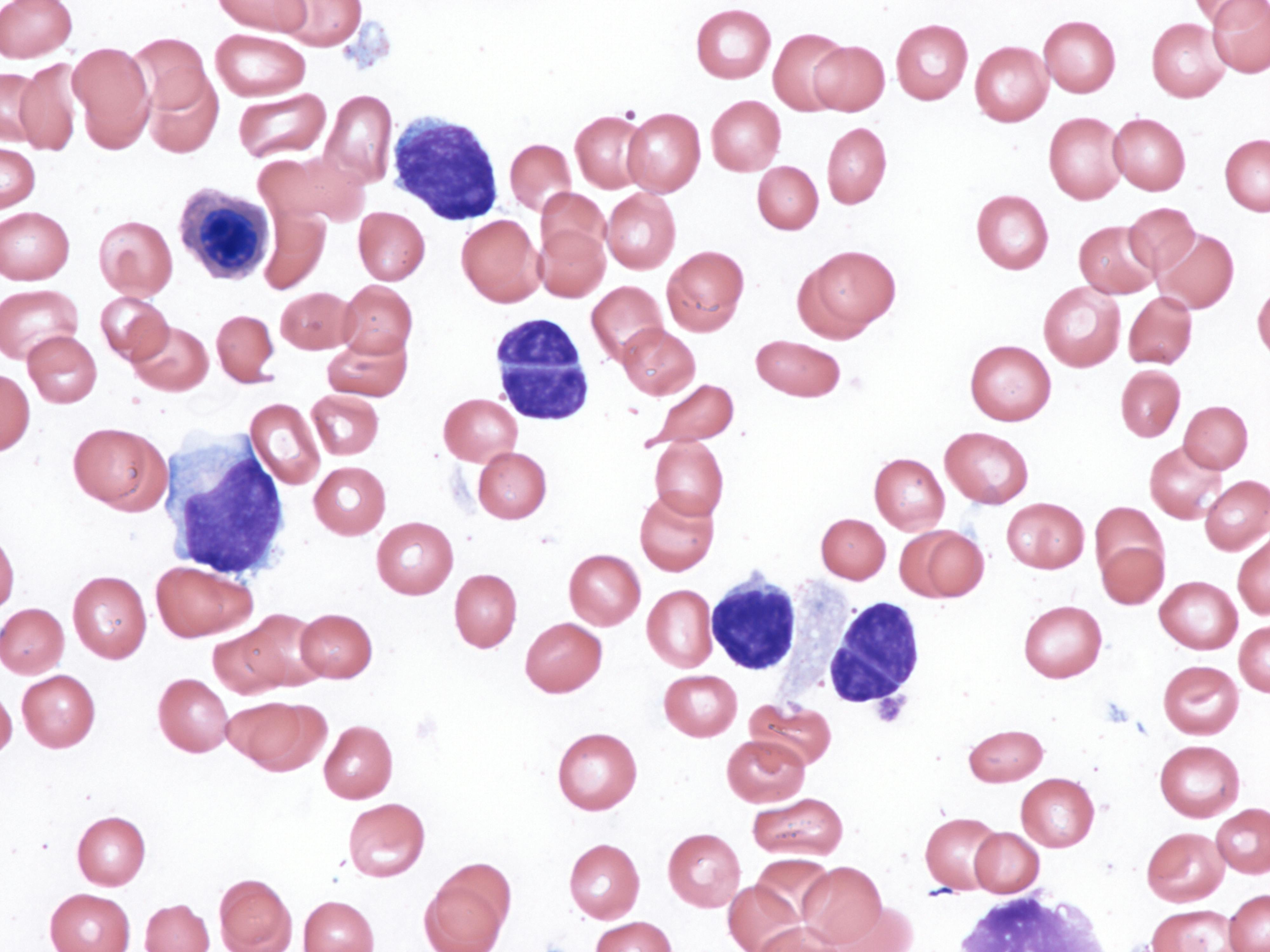 dreamstime_xxl_283644066