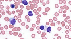 dreamstime_xxl_283644066 dreamstime_xxl_283644066