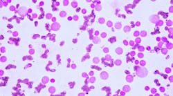 dreamstime_xxl_86265164 dreamstime_xxl_86265164