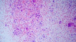 dreamstime_xxl_181938766 dreamstime_xxl_181938766