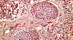 dreamstime_xxl_29670818 dreamstime_xxl_29670818