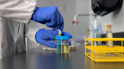 urinalysis_photo urinalysis_photo
