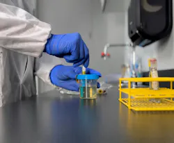 69fb916efb29823f400a5f43 Urinalysis Photo 69fb916efb29823f400a5f43 Urinalysis Photo