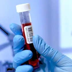 eim_glovedhandholdinglabeled563tube