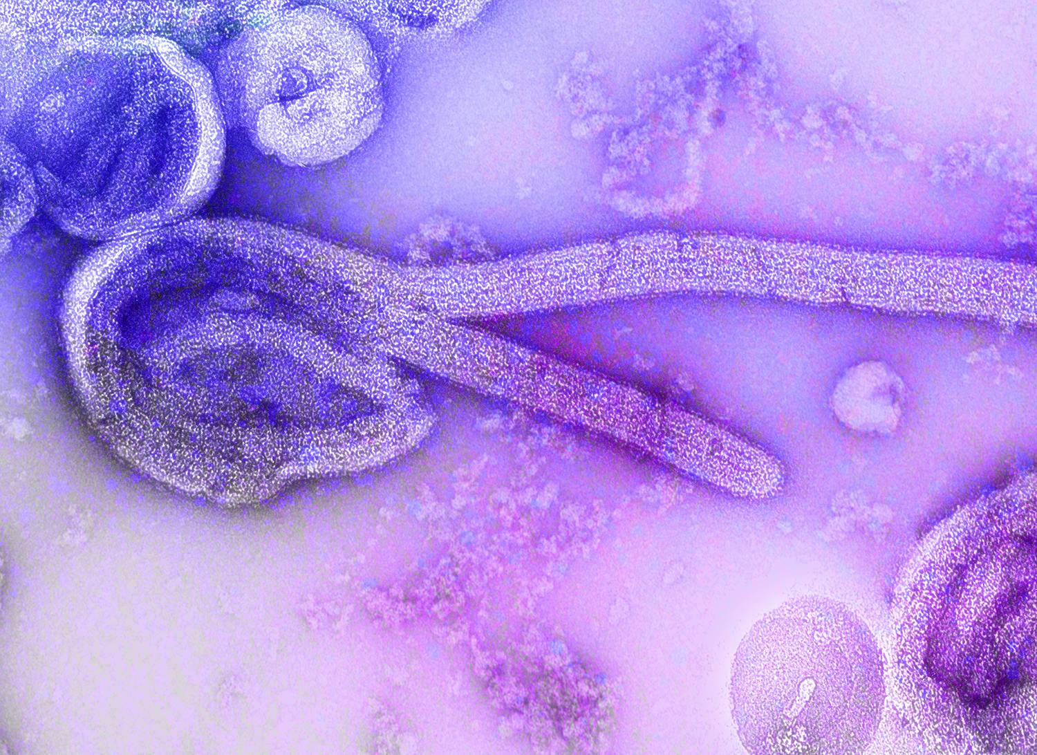 ebola_virus