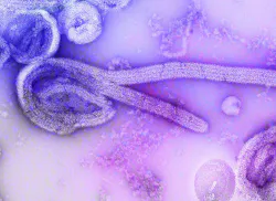 6a99bba9ed224a52133705c4 Ebola Virus